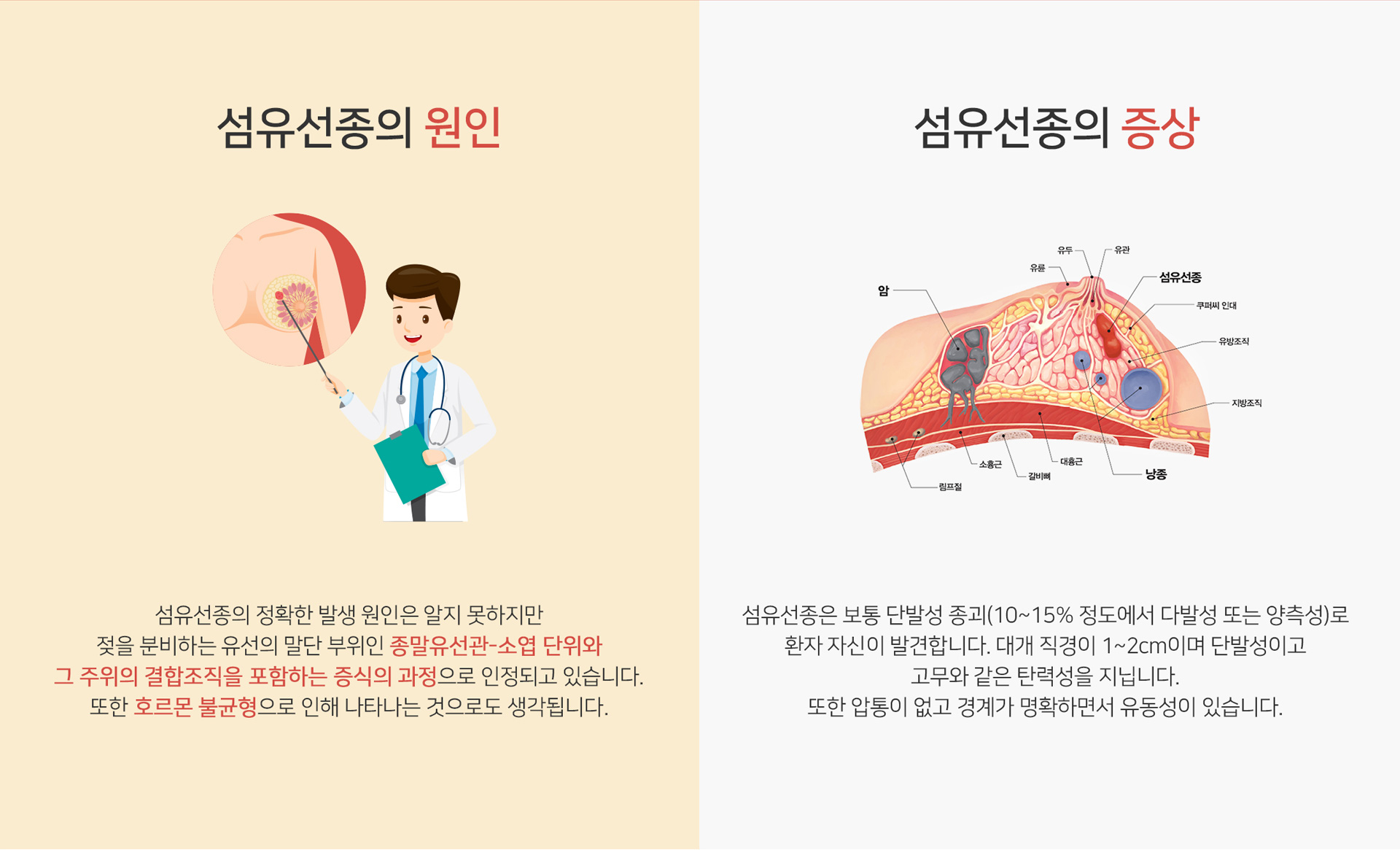 섬유선종의 원인 | 섬유선종의 증상